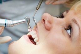 Zähne aufhellen durch professionelle Zahnreinigung