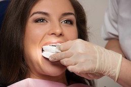 Zähne bleichen durch Zahnbleaching beim Zahnarzt