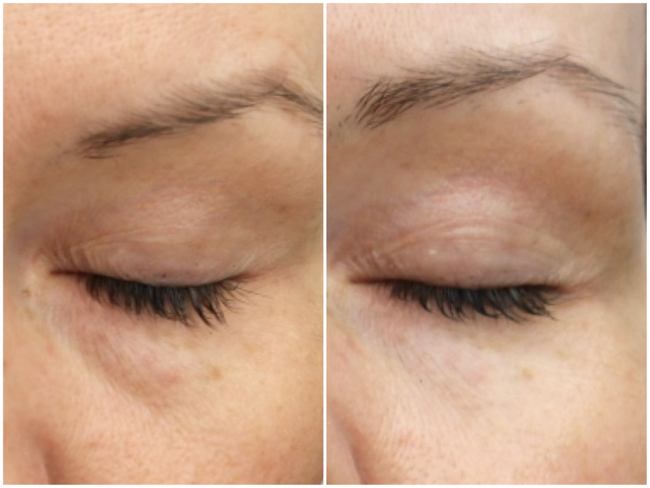 Regulat Beauty Augencreme Test Eyecream Gegen Linien Faltchen