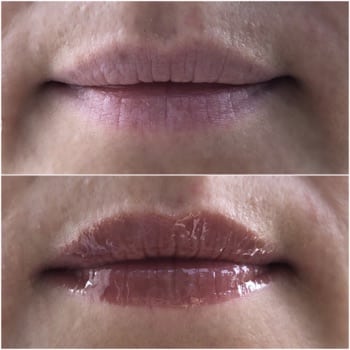 Luscious Lips vorher/nachher