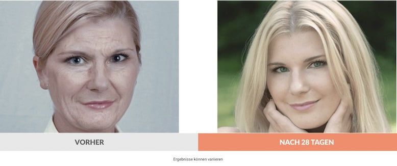Anti-Aging-Creme vorher nachher