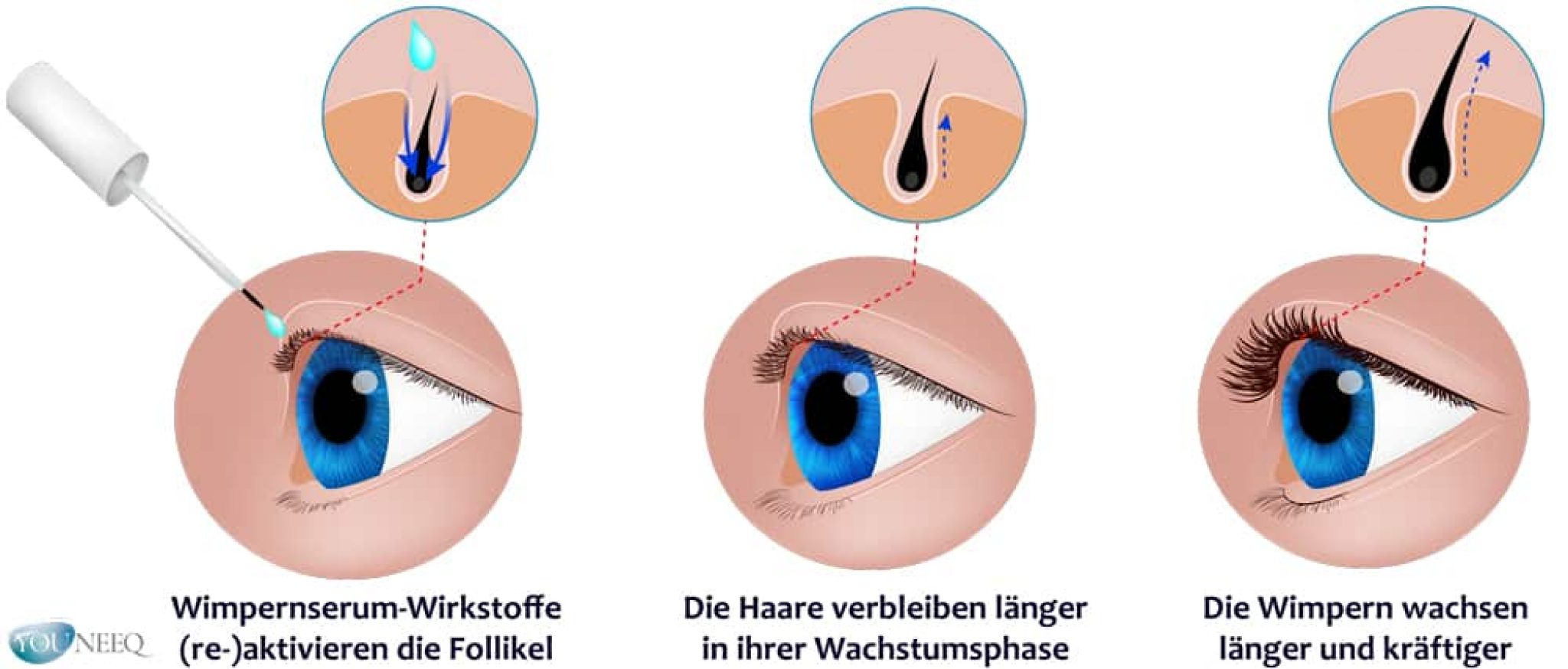 Konnen Wimpern Nachwachsen